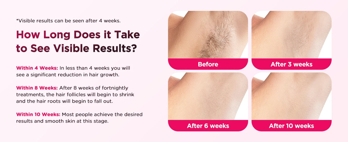 IPL Hair Removal Device