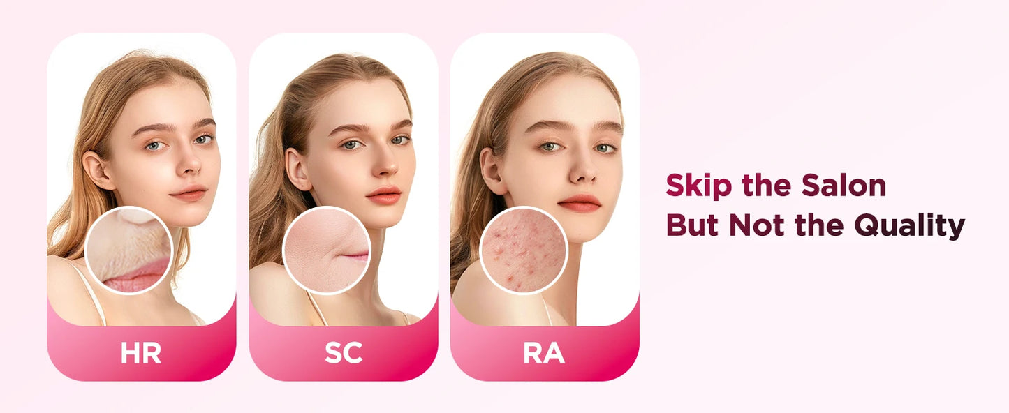 IPL Hair Removal Device